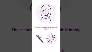 Download lagu The Four Types of #Lupus mp3