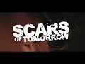 Scars of Tomorrow - The Silence Of Sorrow (Live 11-22-17)