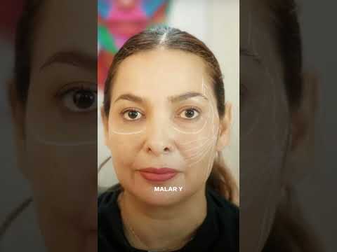 video odSi96bsCSI