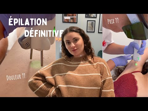 L'ÉPILATION AU LASER - Mon expérience, prix, douleurs...