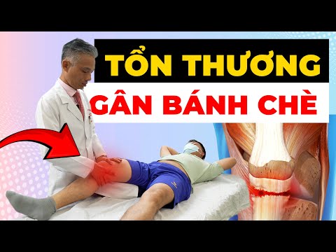 GÂN BÁNH CHÈ BỊ ĐỨT - Sai lầm chết người 90% người mắc