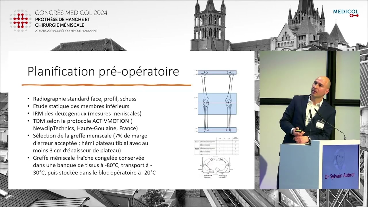 Chirurgie de transplantation méniscale avec guides de coupe sur mesure - Dr Sylvain Aubret
