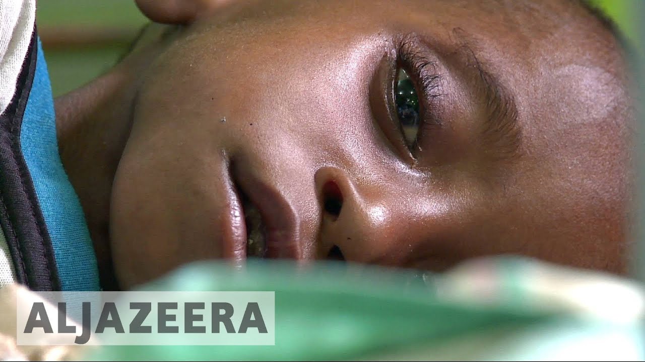 Indonesia: Measles, Chickenpox Kill Dozens of Children
