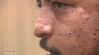 Teen accused of shooting cyclist with shotgun was ‘blowing off steam’