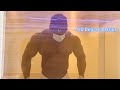 -110 Degree Celsius Cryotherapy (10weeks Out)