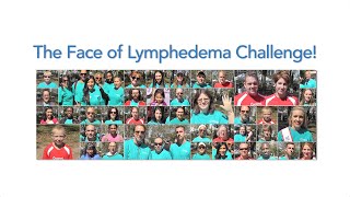 The Face of Lymphedema Challenge!