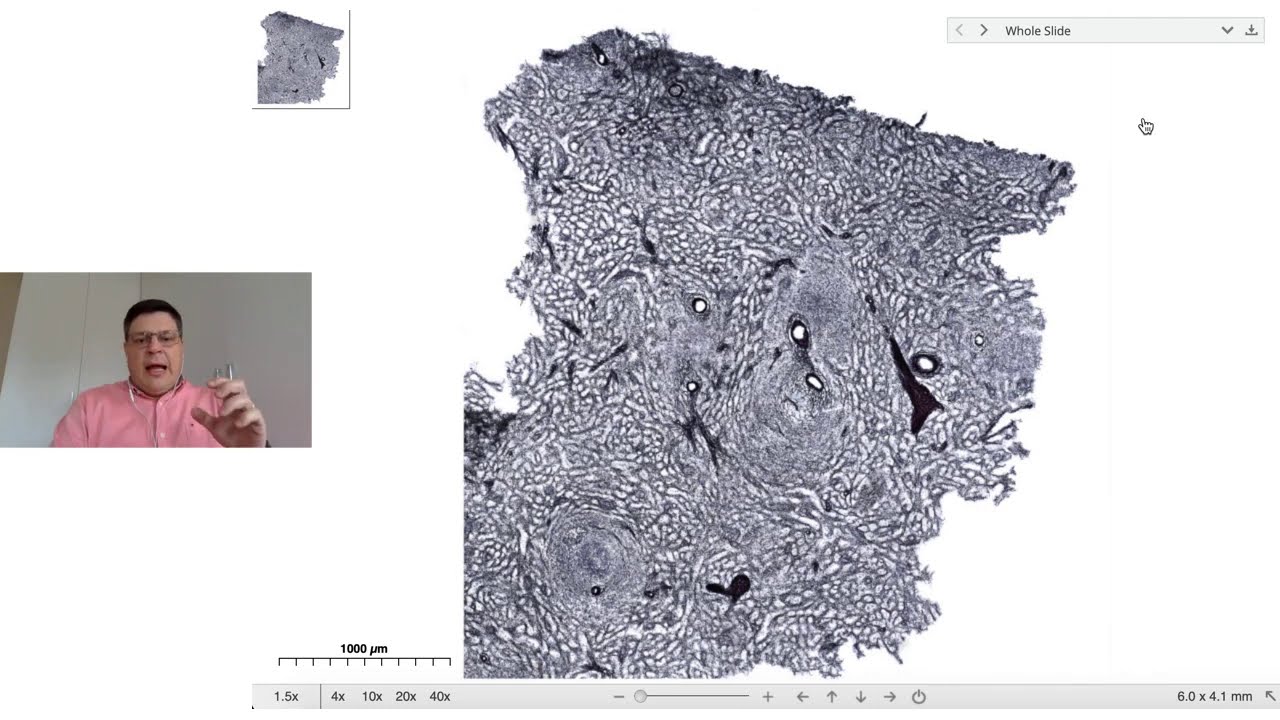 Classificação histológica do tecido conjuntivo propriamente dito