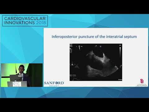 A Successful Complex Percutaneous Coronary Intervention - Maheedhar Gedela, MD
