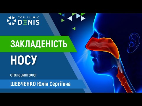 Заложенность носа - TOP Clinic DENIS