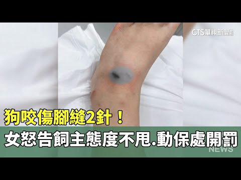 狗咬傷腳縫2針！　女怒告飼主態度不甩　動保處開罰