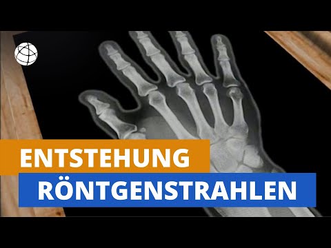 Was die Medizin Einstich für Rückenschmerzen 7 Monate der Schwangerschaft wunden unteren Rücken
