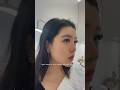 Nose Cheek Filler On An Asian Face Before After Filler Dermalfillers