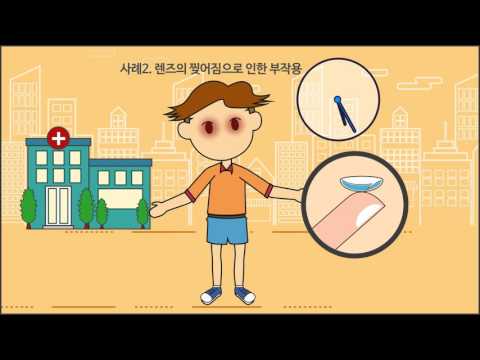 콘택트렌즈 안전하게 사용하는 방법은?이미지