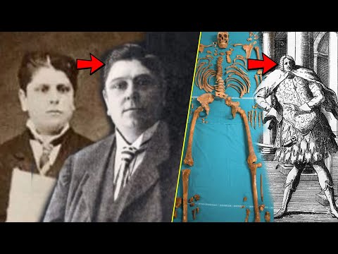 Why The Castrati Never Lost Their Hair AND Grew Very Tall - Science Explained