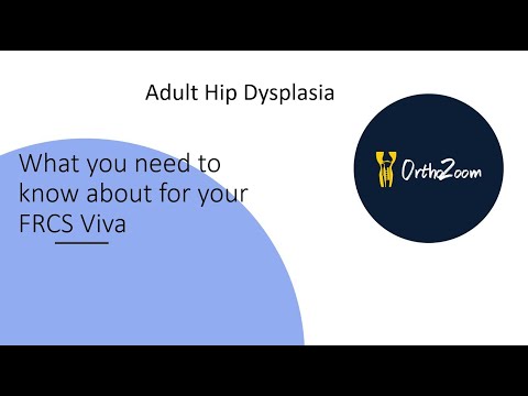Adult hip dysplasia : What you need to know for your FRCS viva