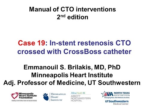 Case 19: Manual of CTO Interventions - CrossBoss for in-stent CTO