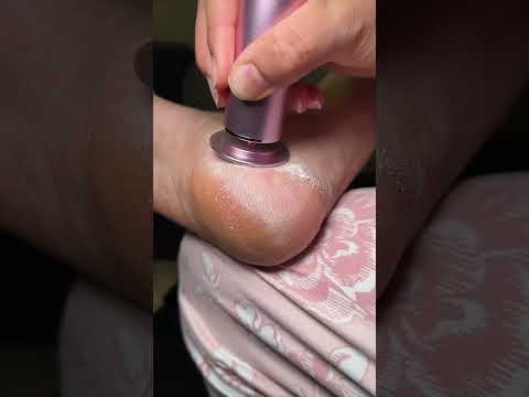 Spa-Quality Foot Care at Home: Dermave Electric Callus Remover