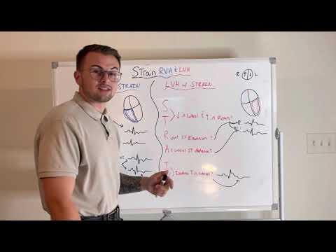 EKG Series: Strain Pattern (LVH and RVH)