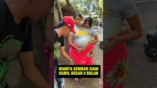 Download lagu Bumil Kembar Siam Hamil Besar 8 bulan mp3 Download lagu Bumil Kembar Siam Hamil Besar 8 bulan mp3