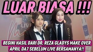 Download lagu BEGINI HASIL DARI DR. REZA GLADYS MAKE OVER APRIL DA7 SEBELUM LIVE BERSAMANYA !! mp3