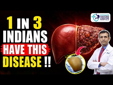 WHY 1 IN 3 INDIANS MAY HAVE FATTY LIVER! Hidden Causes You Must Know