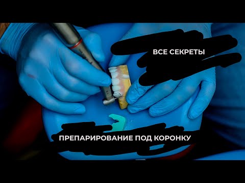 Препарирование под коронку. Все секреты препа