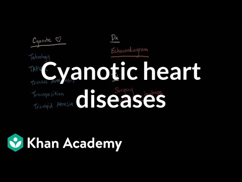 Cyanotic heart diseases - Diagnosis and treatment | NCLEX-RN | Khan Academy