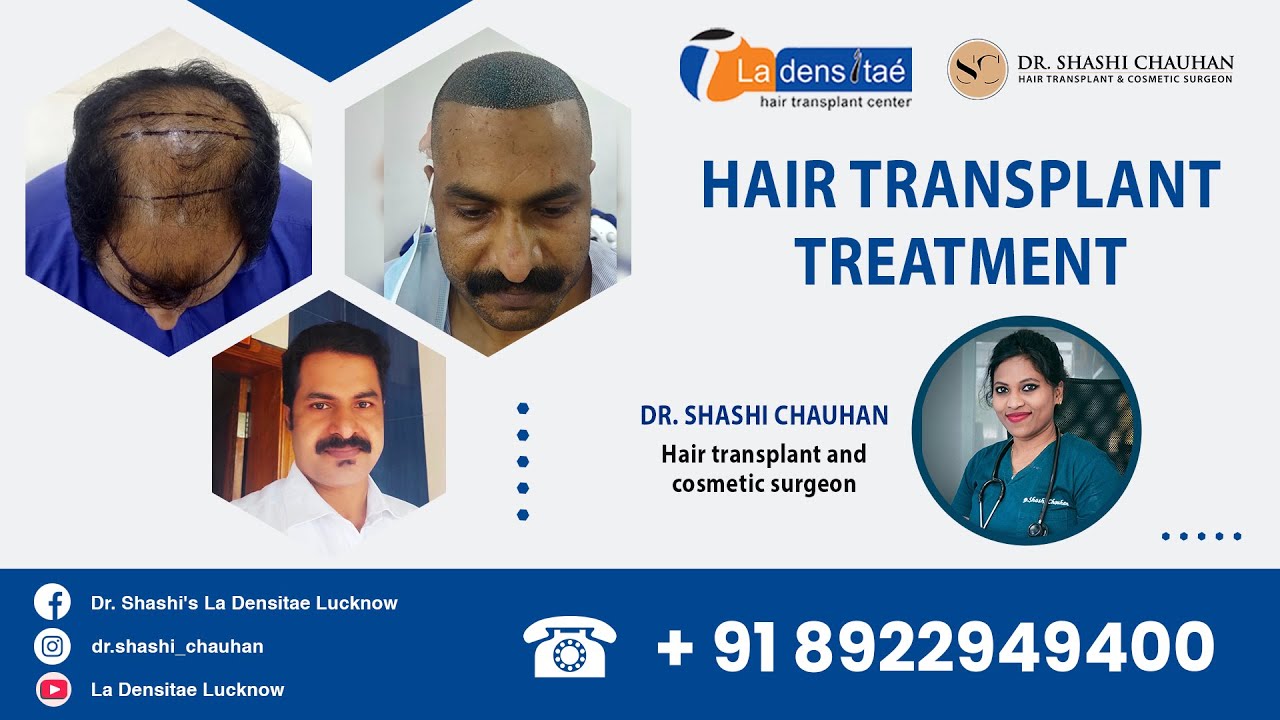 Hair Transplant Treatment in Lucknow | Hair Treatment Results | Dr. Shashi Chauhan