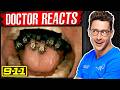 Doctor Reacts To 9-1-1 Bee Attack Episode DEFAULT Thumbnail