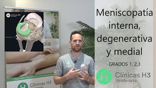 🚶 Meniscopatía interna ,  meniscopatía medial y degenerativa.✅ Fisioterapia para meniscopatía [2021]