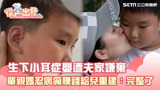 生下小耳症嬰遭夫家嫌棄  單親媽忍病痛賺錢給兒重建：完整了