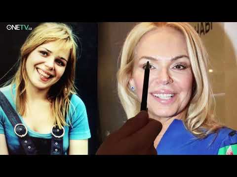 Tohle si rozebereme s tužkou: Kde všude zasahoval plastický chirurg u Dagmar Havlové?