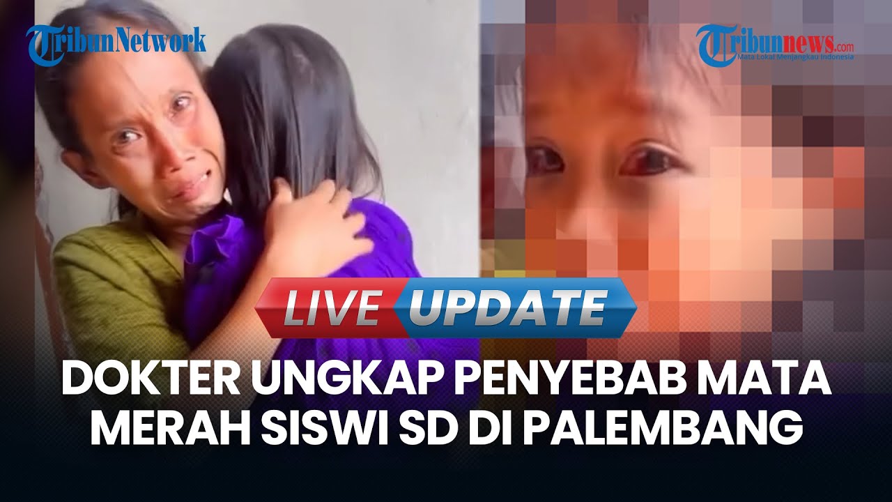 LIVE UPDATE | Dokter Ungkap Penyebab Mata Merah Siswi SD di Palembang, Orang Tua Duga Dipukul Guru