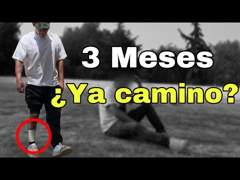 Fractura De Tibia Y Peroné 3er Mes | Respondiendo Preguntas