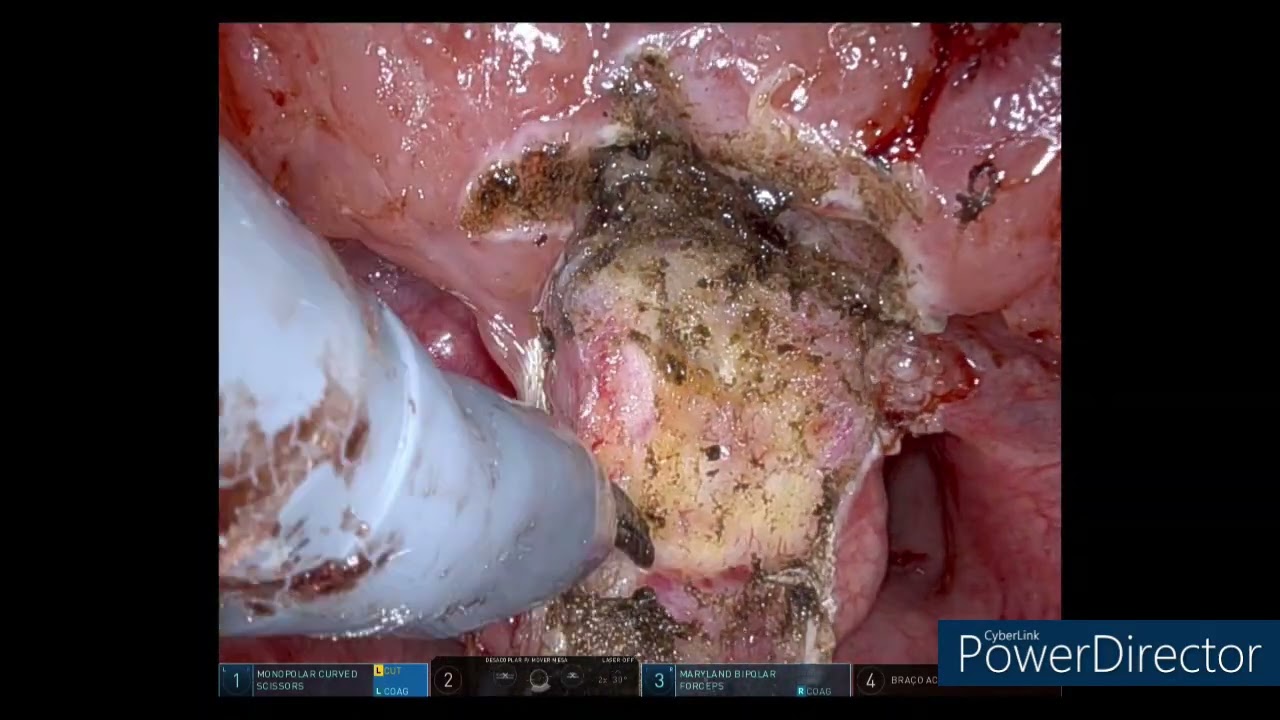 Adriano Santana Fonseca-10