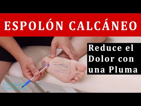 Espolón que duele 🦶 intenta esto! 💛🤗