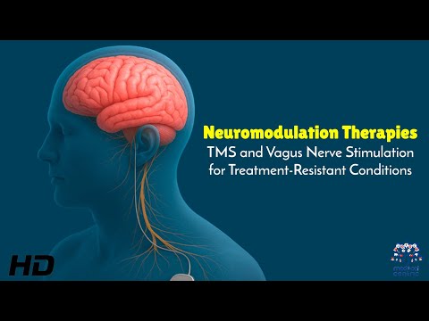 Neuromodulation Therapies : TMS and Vagus Nerve Stimulation for Treatment-Resistant Conditions