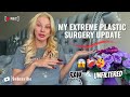 Aging Surgery And Criticism My Vulnerable Journey In My 50s