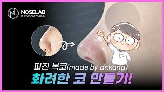 코가 납작하고 들리고 퍼지고... 그런데?