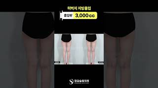 전체적으로 다리선이 훨씬 깔끔해짐 😍