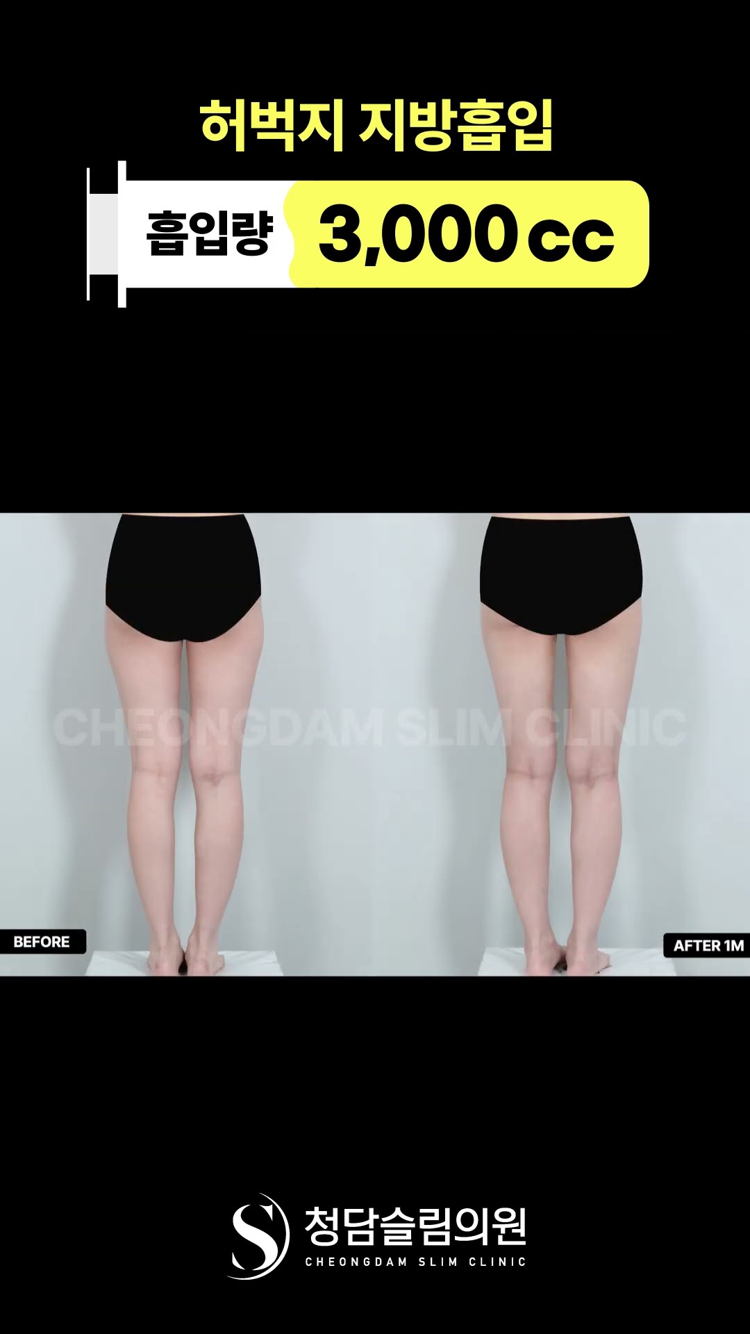 전체적으로 다리선이 훨씬 깔끔해짐 😍