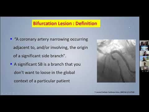 CTO & COMPLEX PCI - Session 4 - " COMPLEX PCI " | Dr.Arun Kalyansundaram | Promed Hospital | Chennai