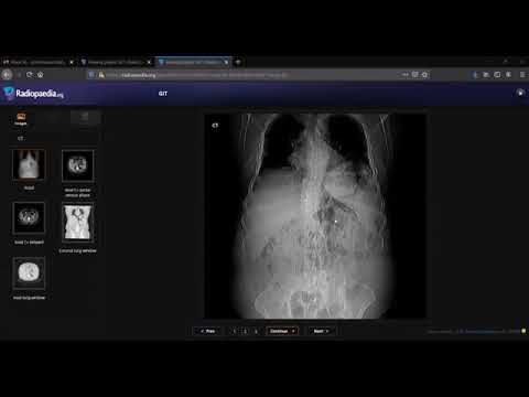 TEAM FRCR 2B VIVA Practice Session (GIT Module). 26th Dec, 2020.