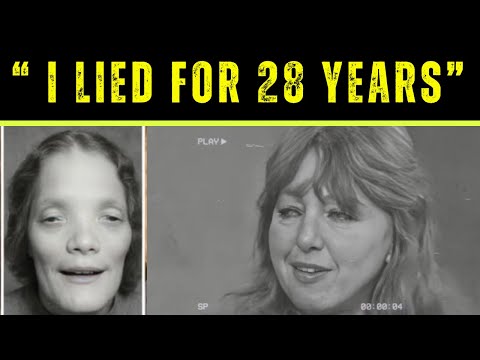 “Mask” Was a Lie — The True Story of Rocky Dennis They Never Showed