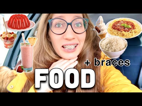 What food to eat when you first get braces / tightened come food shopping with me for braces