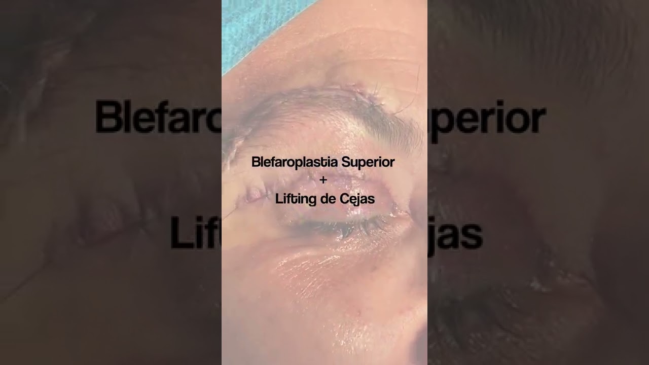 Alexo Carballeira Braña-16