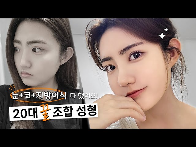 e쁨, 에픽성형외과 E쁨, 에픽성형외과