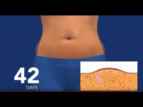 fat metabolizatorul pierde în greutate efecte secundare natural