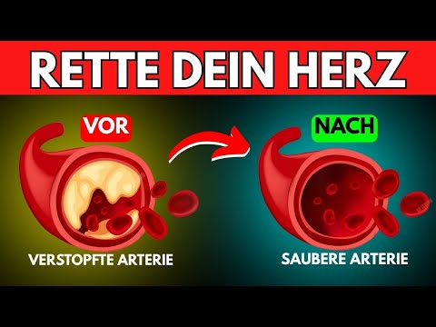 Dieses Essen befreit deine Arterien vom Cholesterin!
