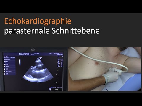 parasternale Schnittebene - Echokardiographie